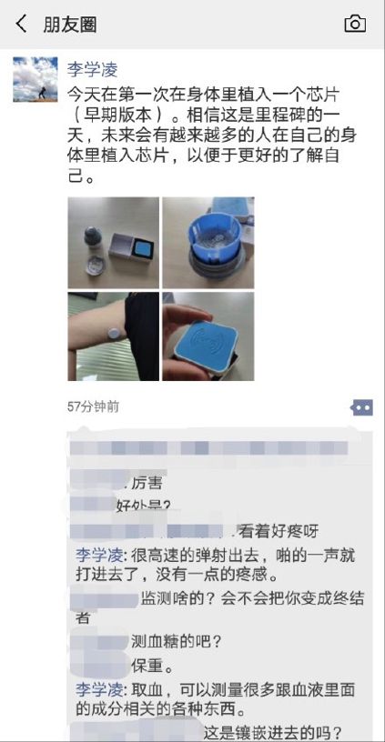 李学凌胳膊植入芯片 生物黑客先驱还是行业新方向？_人物_电商报